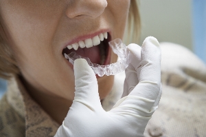 All Smiles Dental | Invisalign Treatment - Dentist Geelong